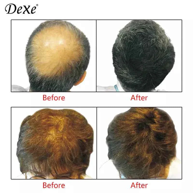 Dexe Hair Building Fibers - BD Drop